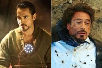 Iron Man News | आइरन मैन से प्रेरित होकर, चीनी नागरिक ने पैर से धातु के टुकड़े निकालने के लिए चुंबक का उपयोग किया।