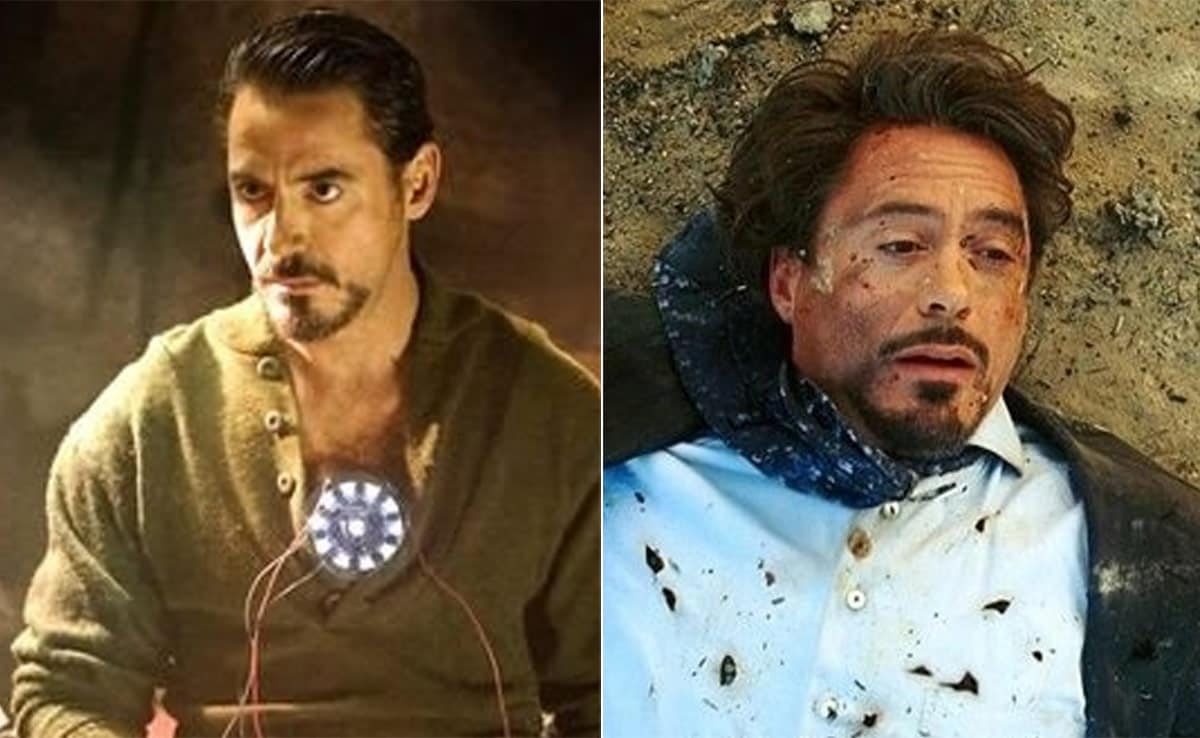 Iron Man News | आइरन मैन से प्रेरित होकर, चीनी नागरिक ने पैर से धातु के टुकड़े निकालने के लिए चुंबक का उपयोग किया।